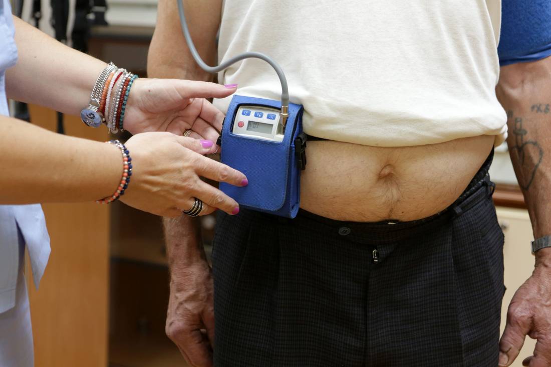 24-satno kontinuirano mjerenje arterijskog tlaka (Holter tlaka, KMAT)