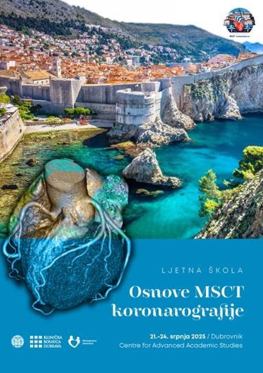 Ljetna škola MSCT koronarografije